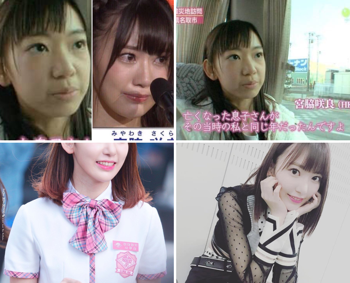 宮脇 咲 良 整形 モンスター