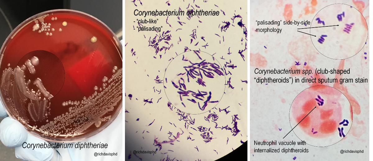 Rich Davis, PhD, D(ABMM), MLS🧫🦠 on X: 