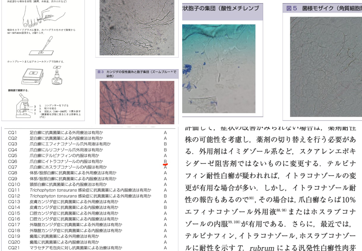 SoS@皮膚科専門医試験対策編 on X: 