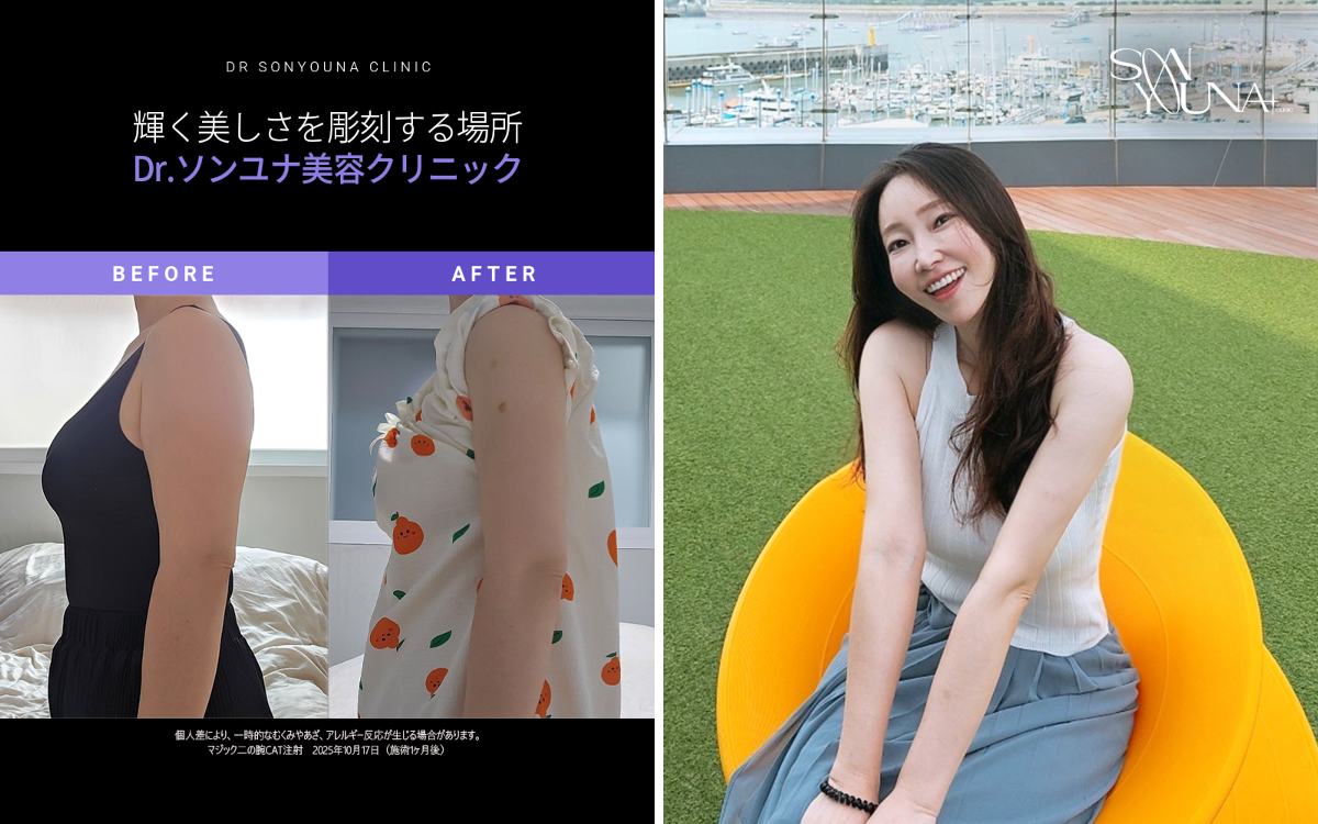 Dr.ソンユナ美容クリニック على X: 