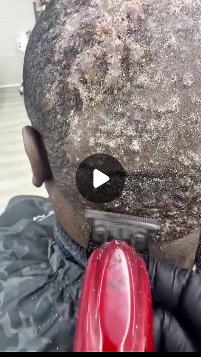 Mobolaji A_Y on X: 