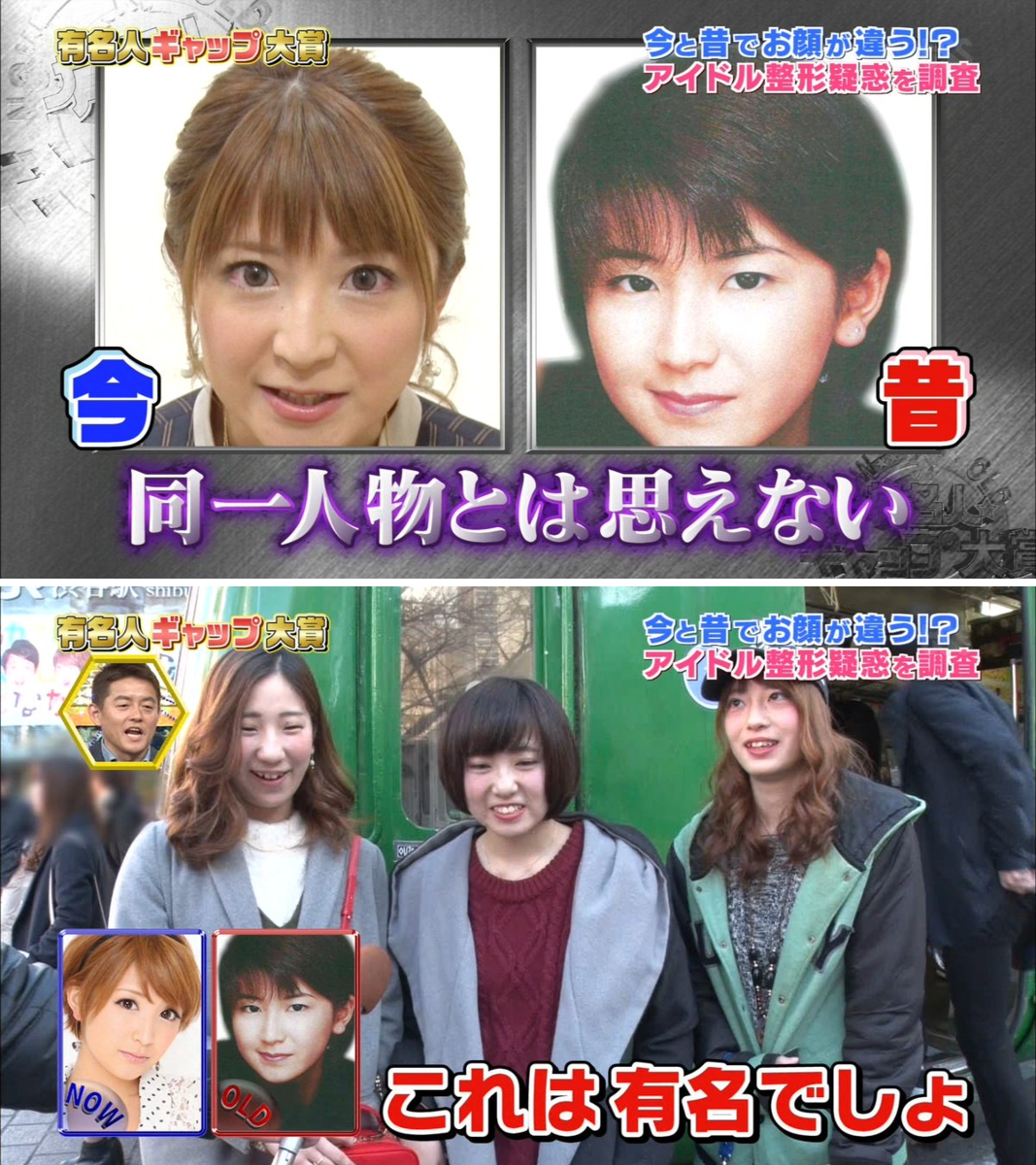 矢口 真里 整形