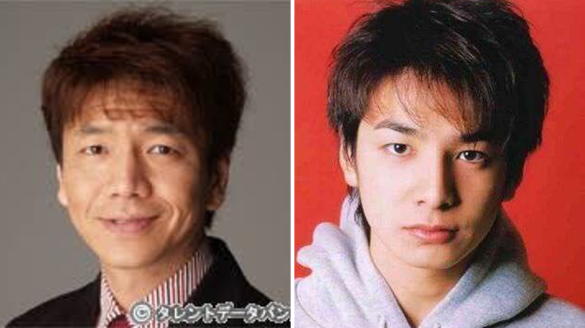 生田 斗 真 整形
